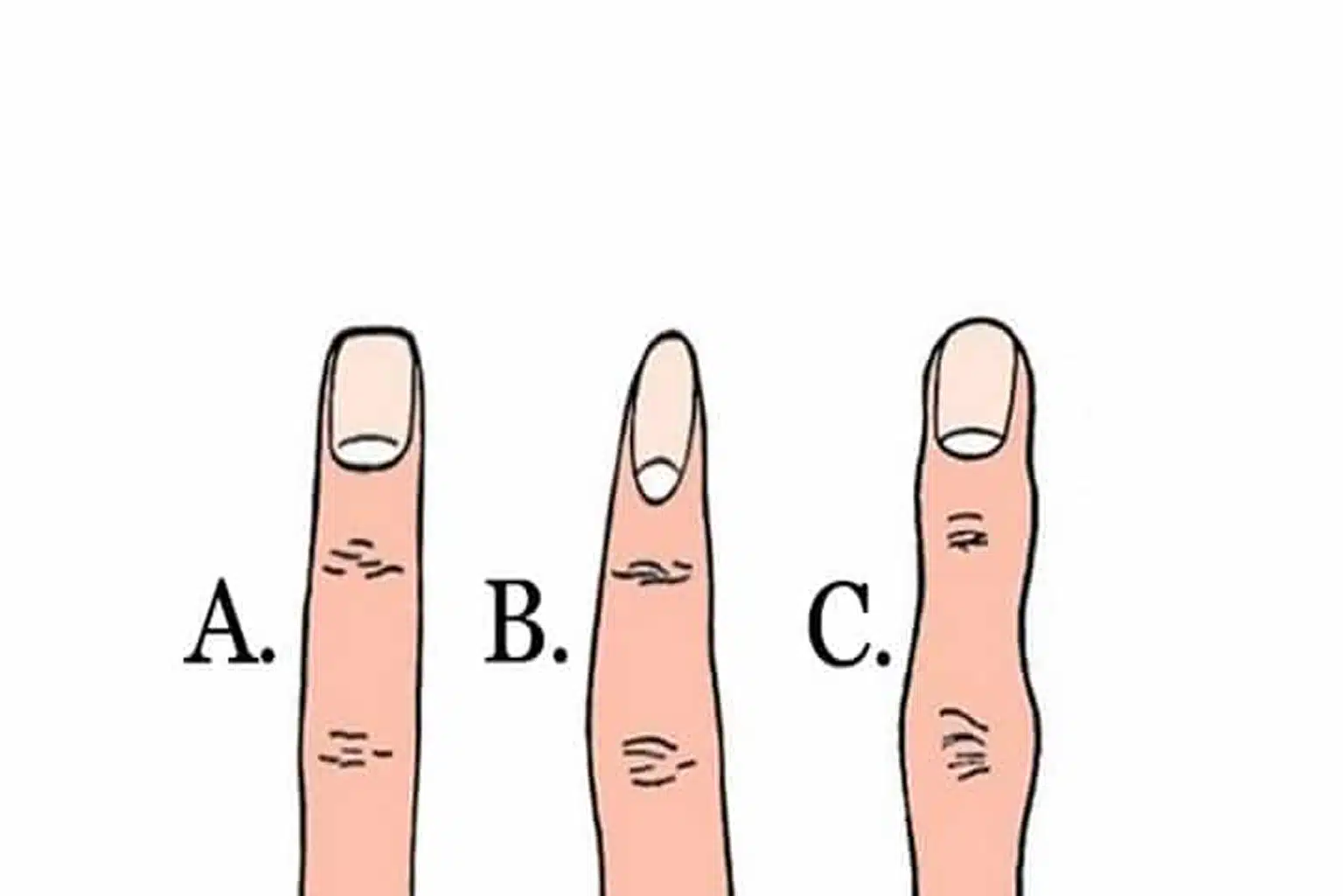 É isso que a forma do seu dedo revela sobre sua personalidade