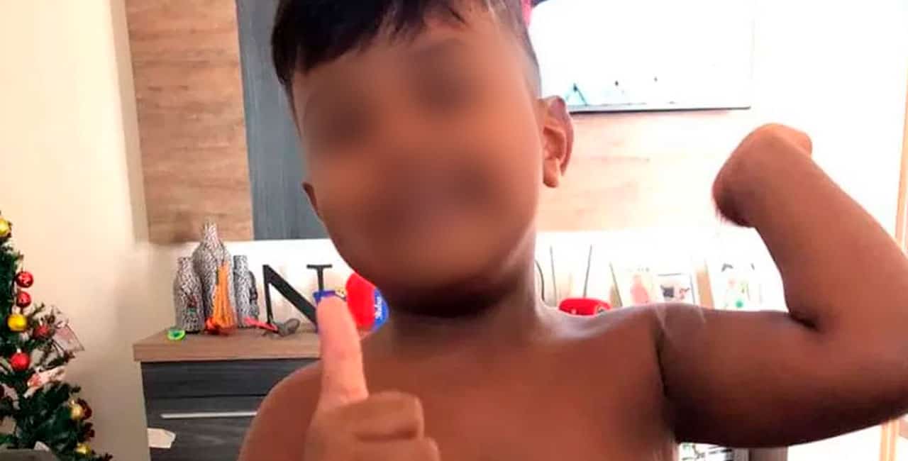 Um Menino De 7 Anos Morreu Depois De Se Engasgar Com Um Chiclete Em Tupã, No Interior De São Paulo.