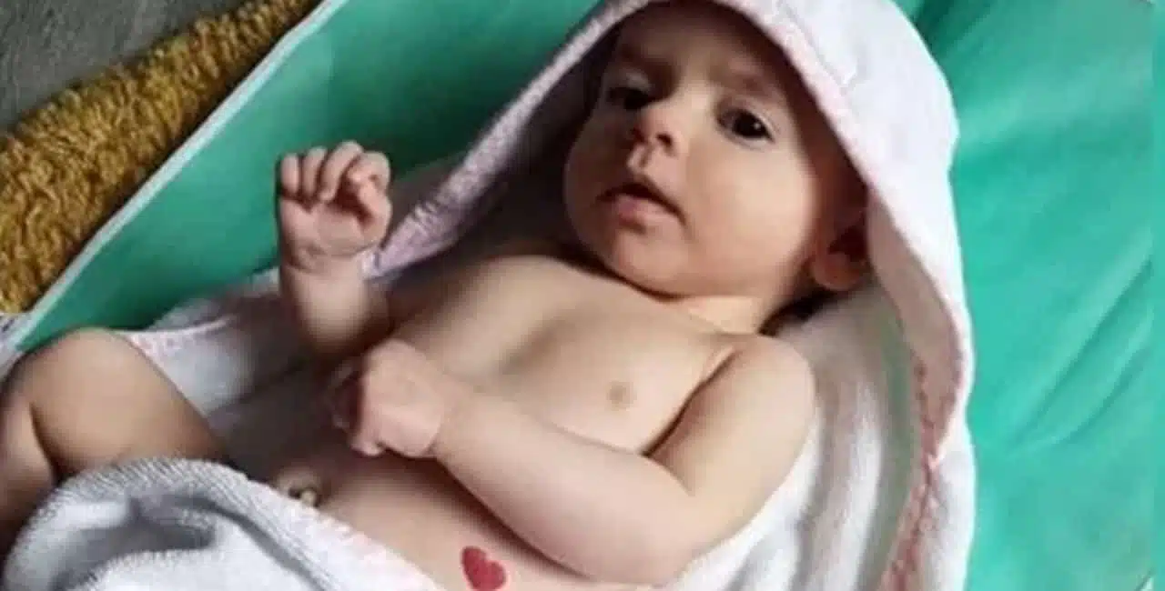 Bebê Nasceu Com Marca De Coração Na Barriga