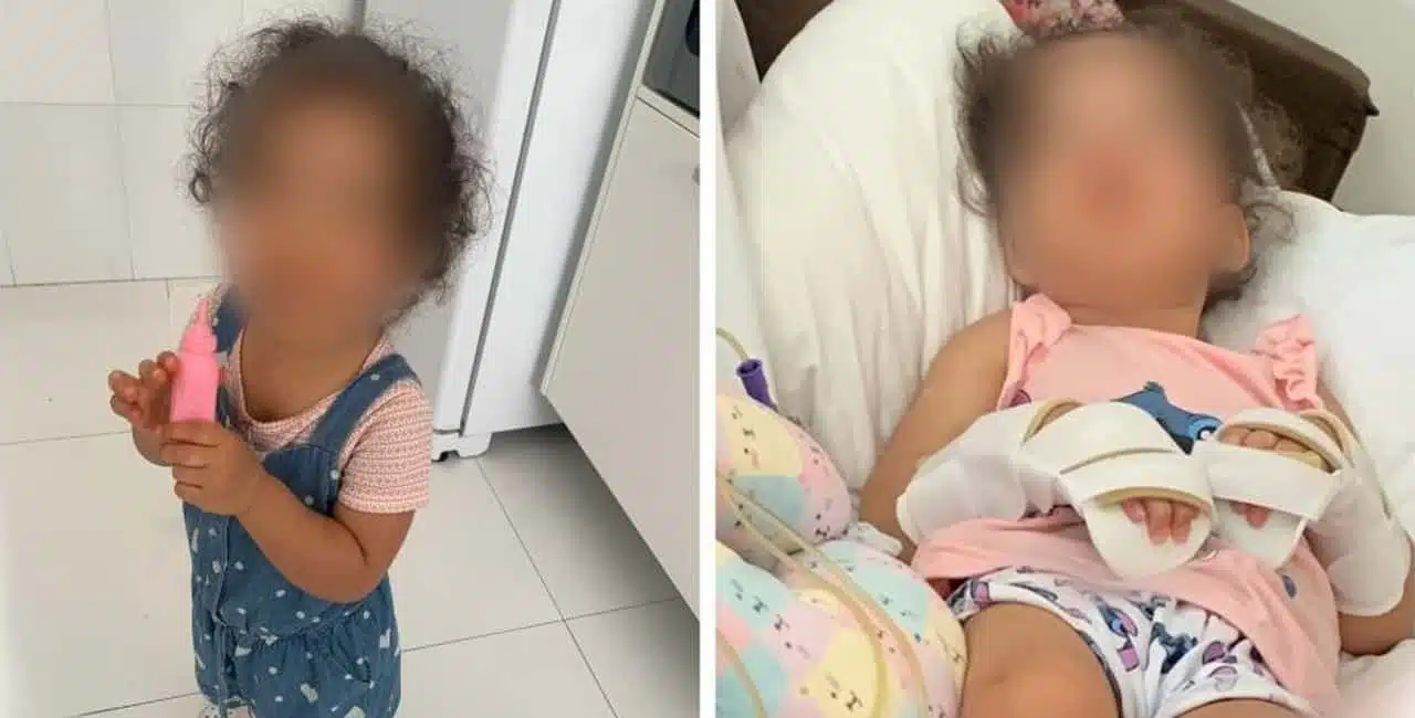Beatriz, De 2 Anos, Foi Levada Ao Hospital Sepaco, Em São Paulo, Com Sintomas De Gripe, Mas Deixou A Unidade Com Paralisia Cerebral.