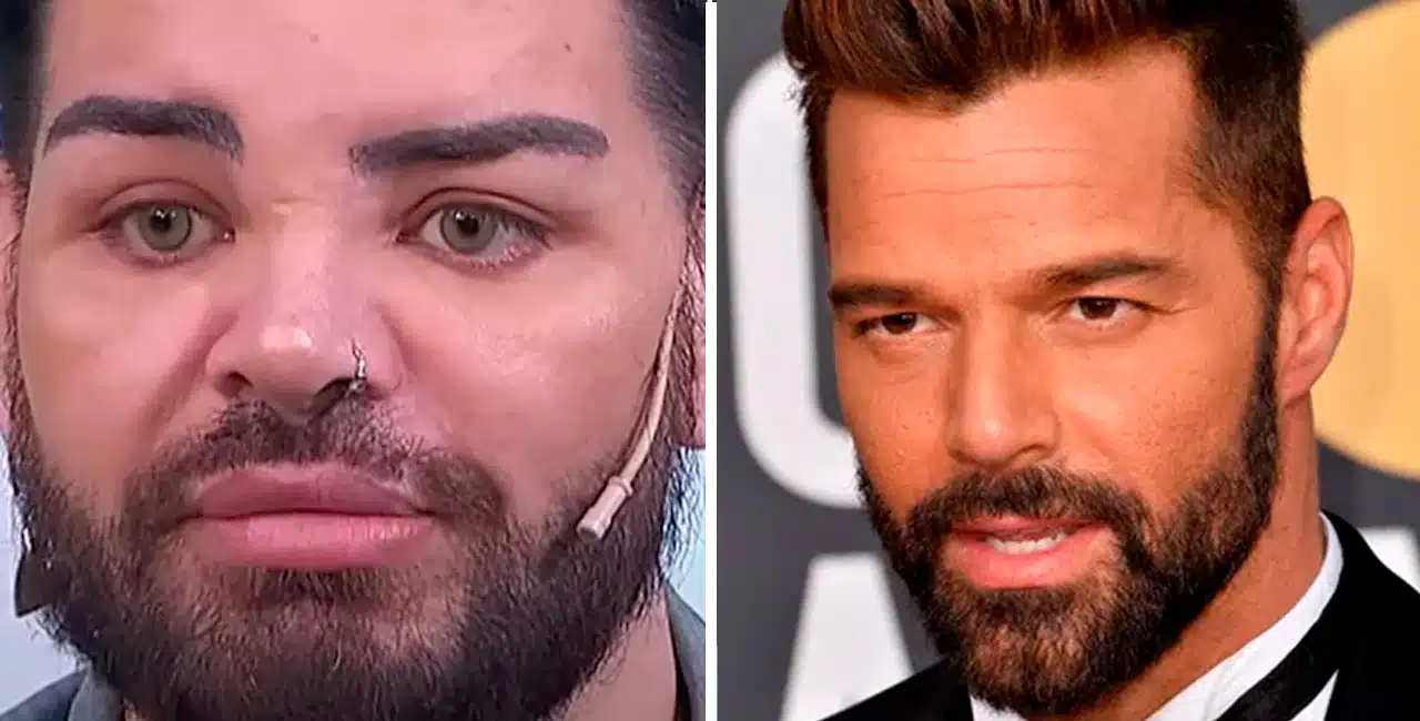 Homem Passa Por 30 Cirurgias Plásticas Para Se Assemelhar A Ricky Martin; Confira