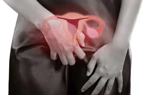 Corrimento Vaginal: Saiba Quais São Os Tipos E Entenda As Alterações