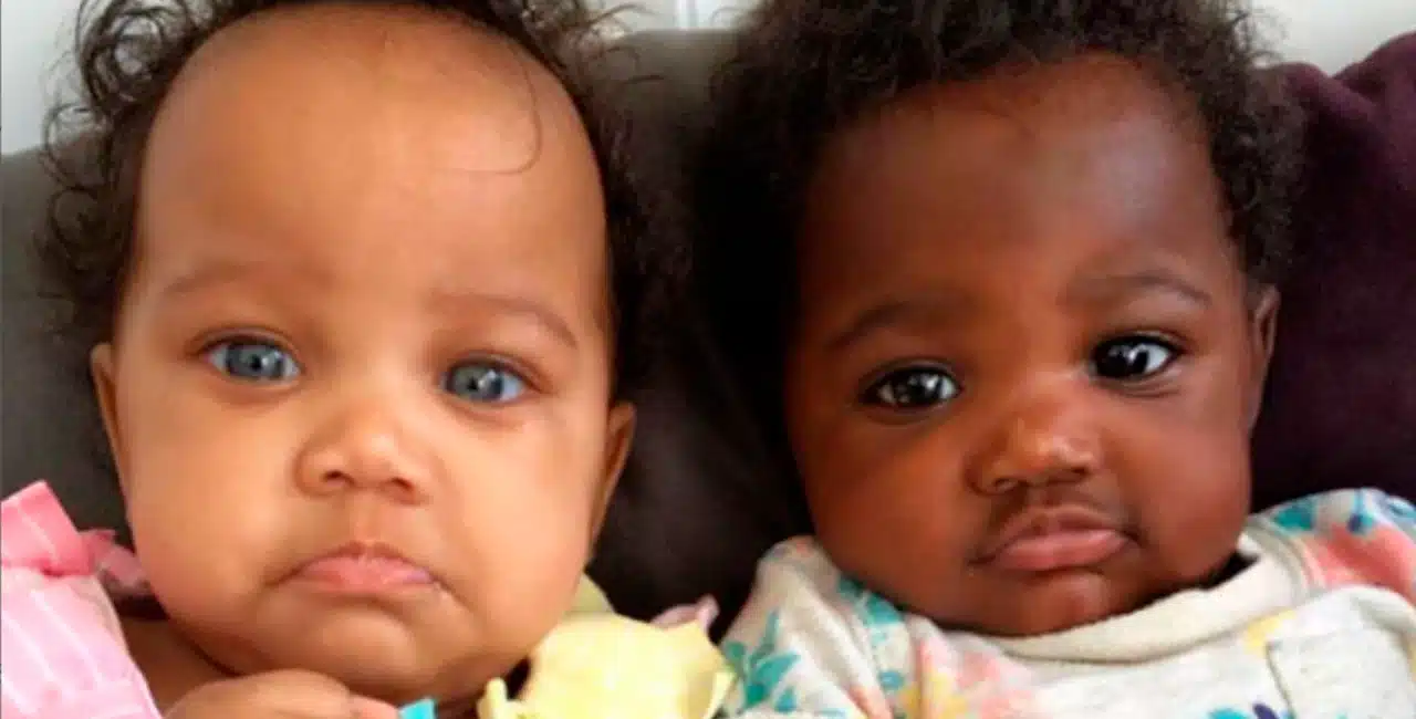 As Gêmeas Nasceram Com Tons De Pele Diferentes E Encantam A Internet Com Momentos Juntas