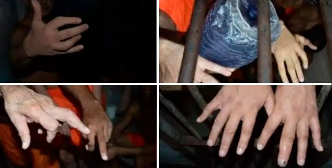 Técnica De Tortura Com Fratura De Dedos É Empregada Em Cinco Estados Brasileiros