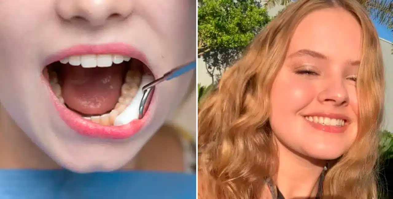A Jovem De 18 Anos Morreu Após Complicações Provocadas Pela Retirada Dos Dentes Do Siso No Interior De Sp