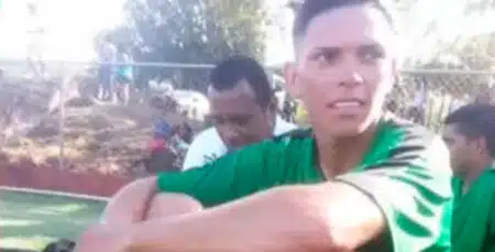 Crocodilo Ataca E Devora Jogador De Futebol Na Costa Rica