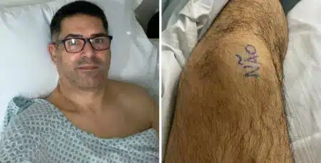 Paciente Marca Joelho Com &Quot;Sim&Quot; E &Quot;Não&Quot; Antes De Cirurgia Em Fortaleza