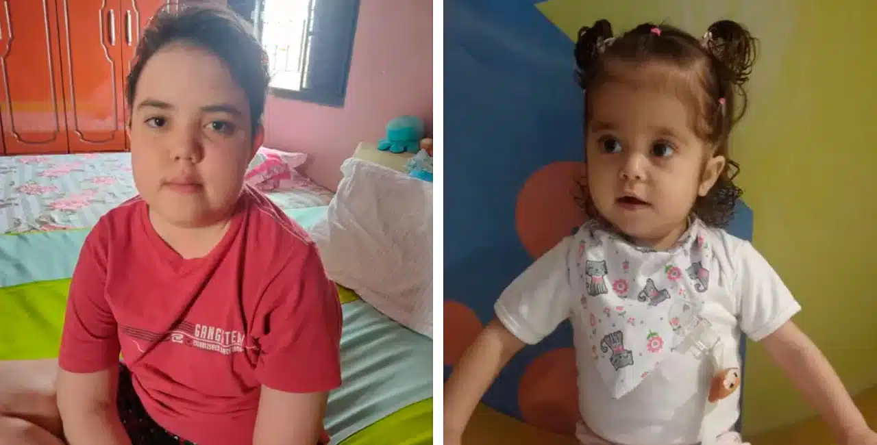Transplante Split: Crianças São Salvas Com Fígado Dividido Em Dois Em São Paulo