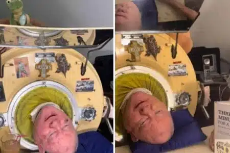 Homem Que Usou Pulmão De Ferro Por 70 Anos Morre De Covid-19