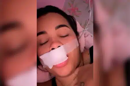 Vídeo: Modelo Tem Parte Do Lábio Arrancado Por Mordida Ao Tentar Beijar Cachorro No Piauí