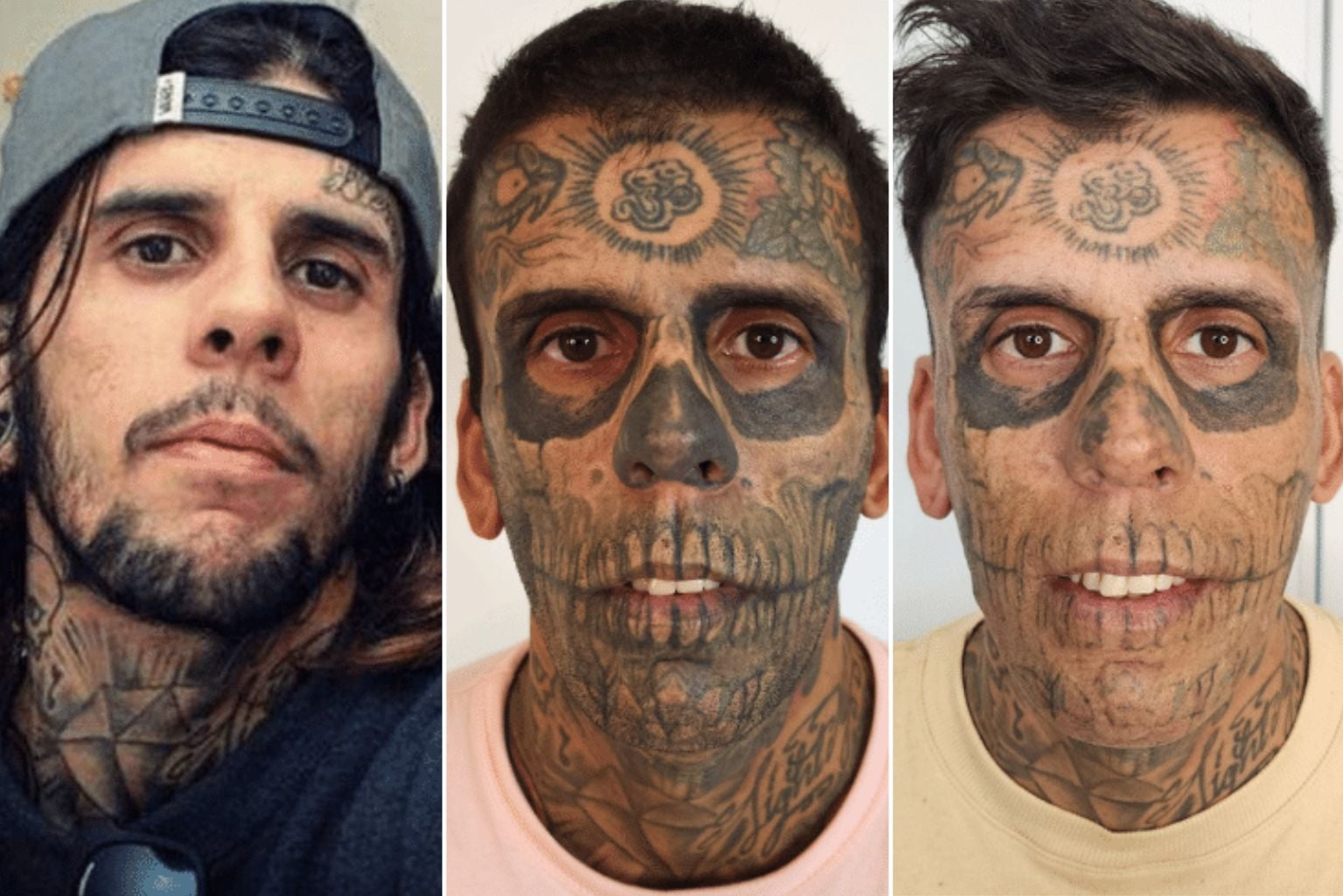 Agora Evangélico, O &Quot;Homem Mais Tatuado Do Brasil&Quot; Inicia Remoção De Tatuagens