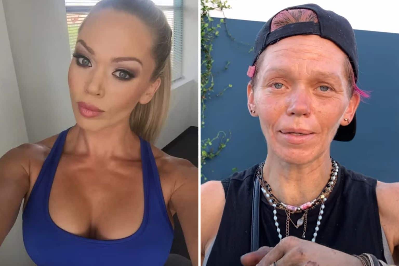 Ex-modelo Loni Willison, em situação de rua, exibe dedos deformados em imagens chocantes