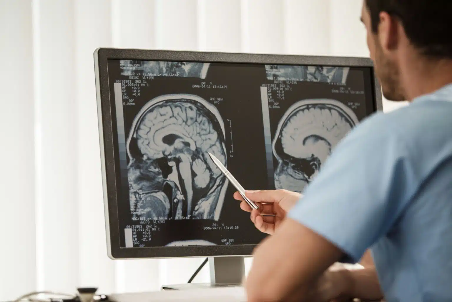 Especialista Revela Teste Com As Mãos Que, Em 30 Segundos, Pode Indicar Condição Cerebral Oculta