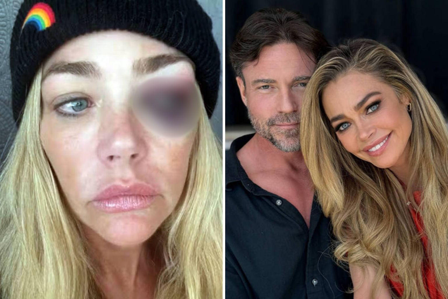 Denise Richards Relata Anos De Abuso E Acusa Ex-Marido De Agressão: &Amp;Quot;Temia Ser Morta&Amp;Quot;