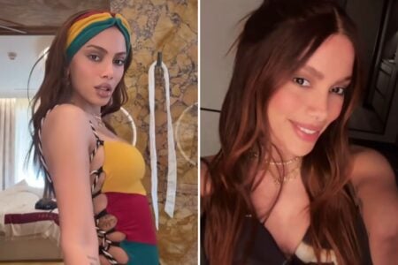 Anitta: Os Procedimentos Estéticos Que Moldaram O Corpo Da Cantora — Preenchimento Labial, Rinoplastia E Mais