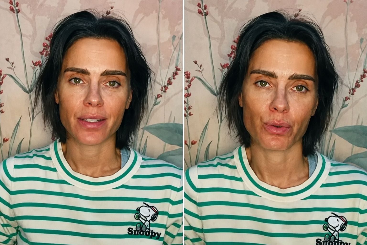 Carolina Dieckmann Faz Alerta Após Contrair Infecção