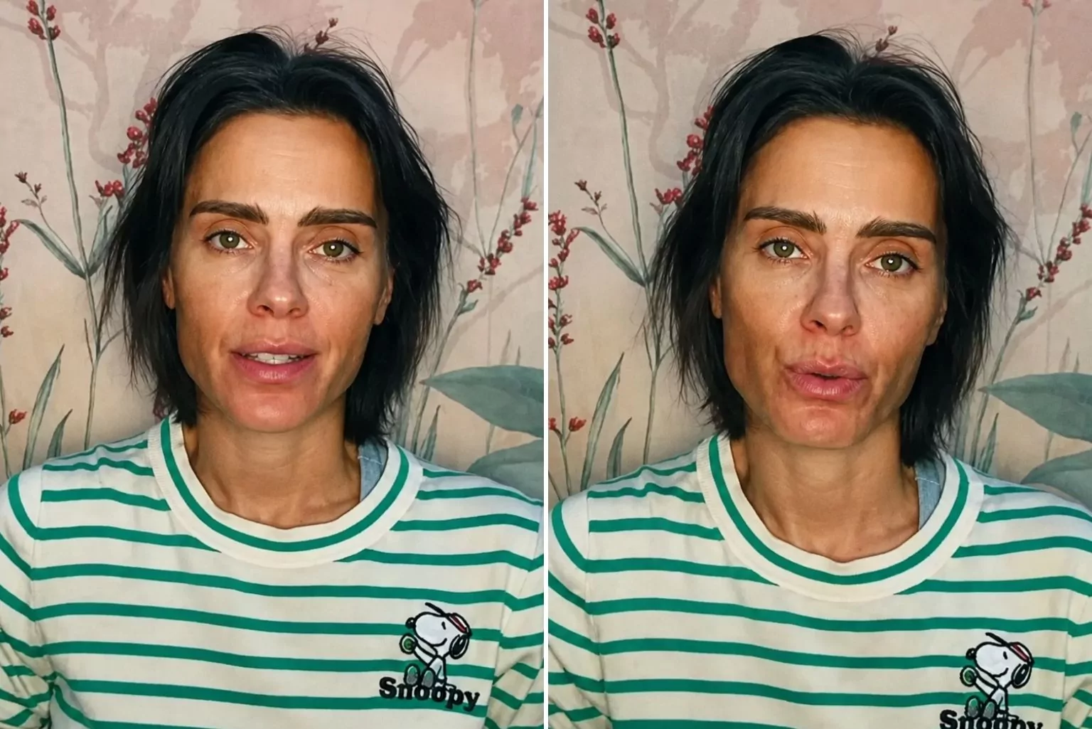 Carolina Dieckmann Faz Alerta Após Contrair Infecção