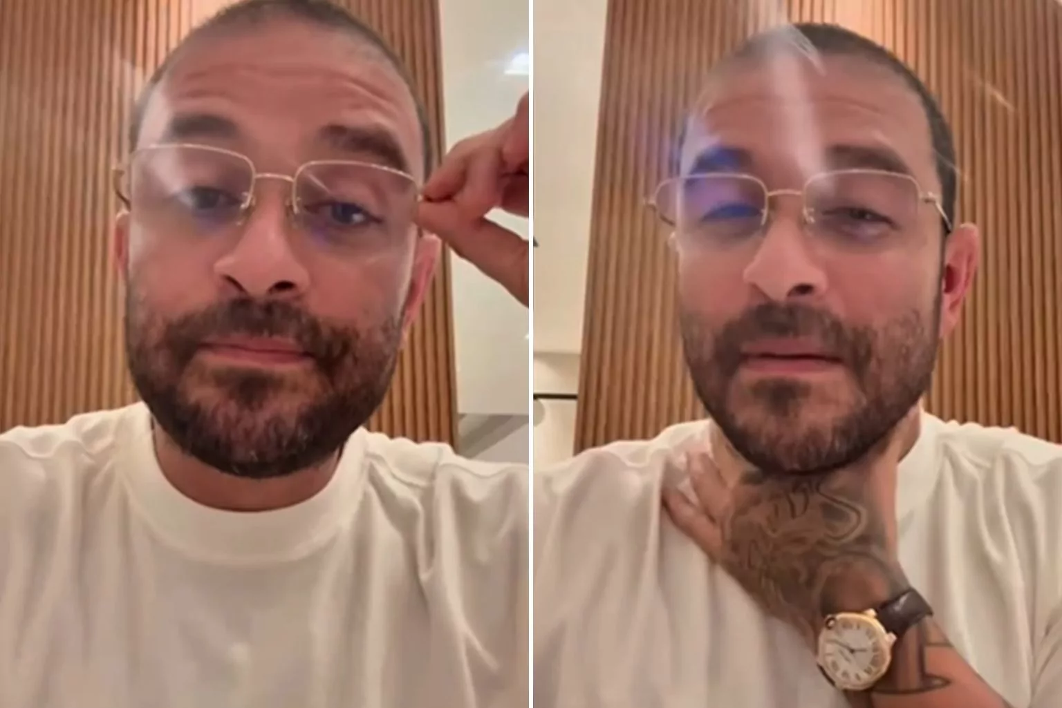 Diogo Nogueira Revela Que Teve &Amp;Quot;Candidíase Nas Cordas Vocais&Amp;Quot; E Explica Tratamento Com Aparelho