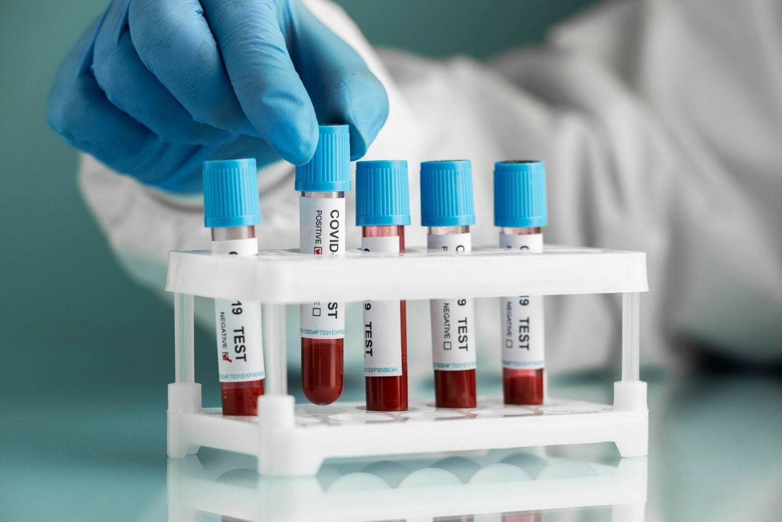 Novo Exame De Sangue Busca Detectar Câncer E Apontar Onde Ele Pode Estar; Entenda