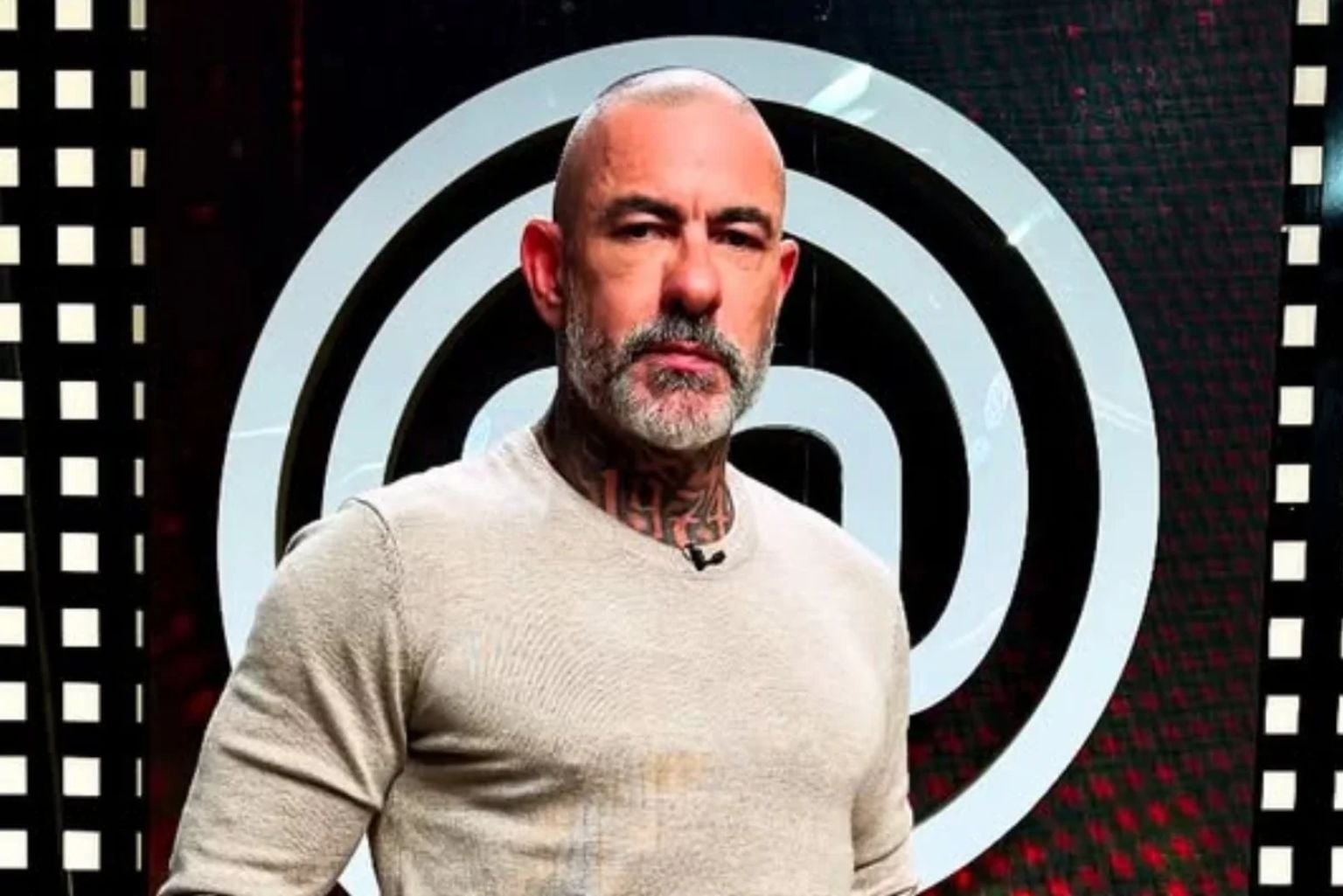 Henrique Fogaça mostra lesões após acidente que o afastou do MasterChef Henrique Fogaça Mostra Lesões Após Acidente Que O Afastou Do Masterchef