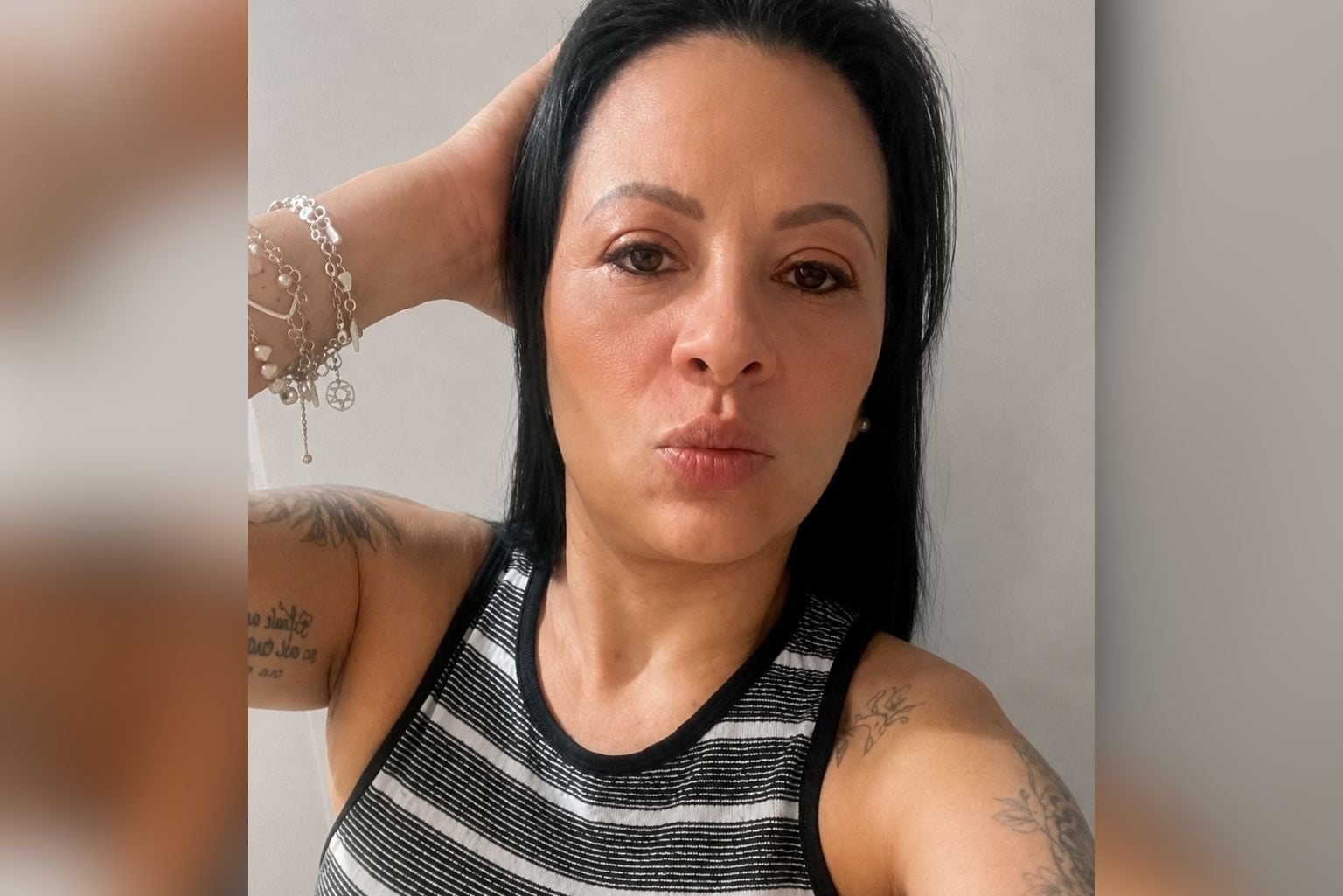 Mulher Morre Após Ter O Intestino Perfurado Durante Colonoscopia Em Hospital De São Paulo