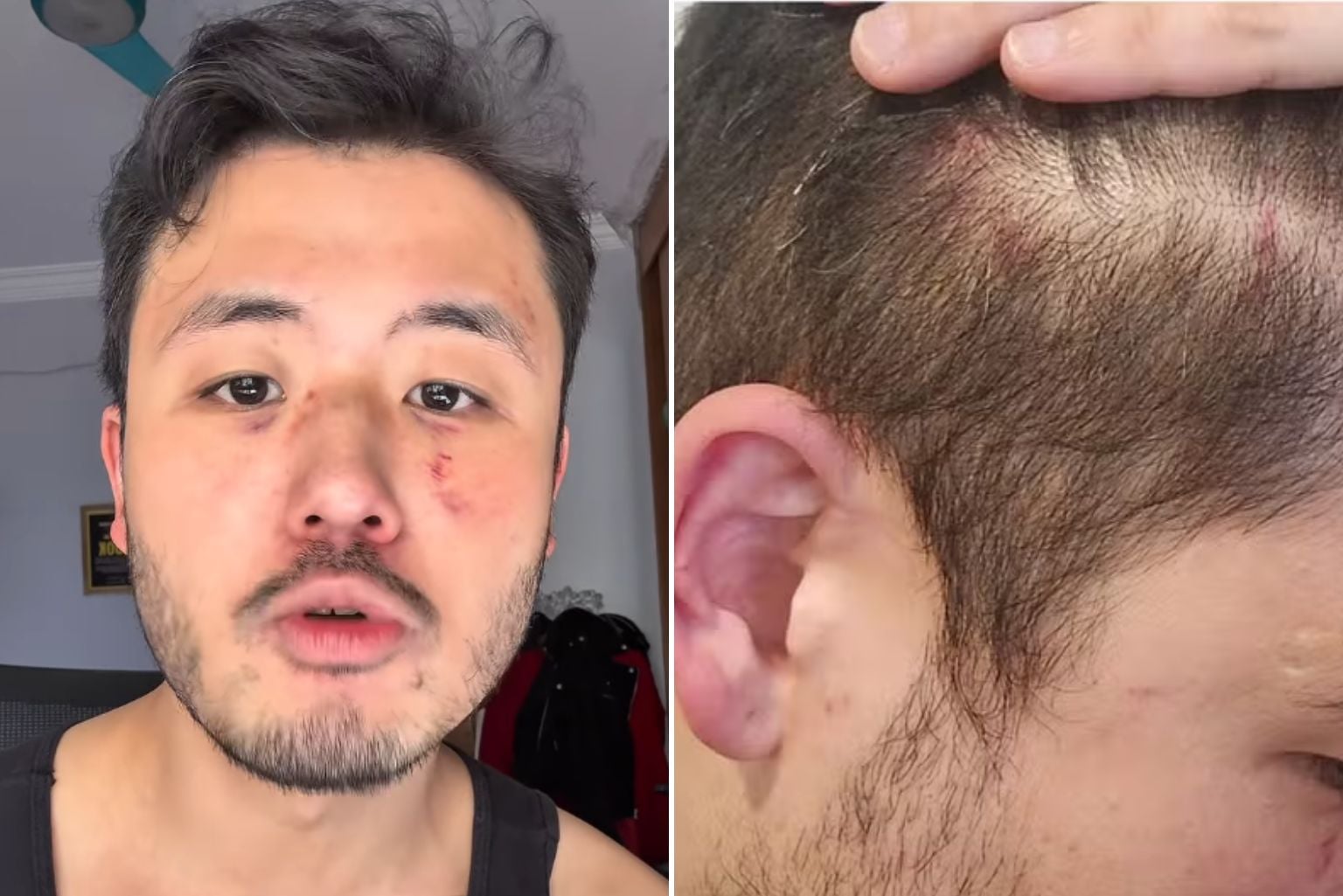 Professor é espancado no metrô de SP e tem tímpano perfurado: "Ninguém ajudou" Professor É Espancado No Metrô De Sp E Tem Tímpano Perfurado: &Quot;Ninguém Ajudou&Quot;