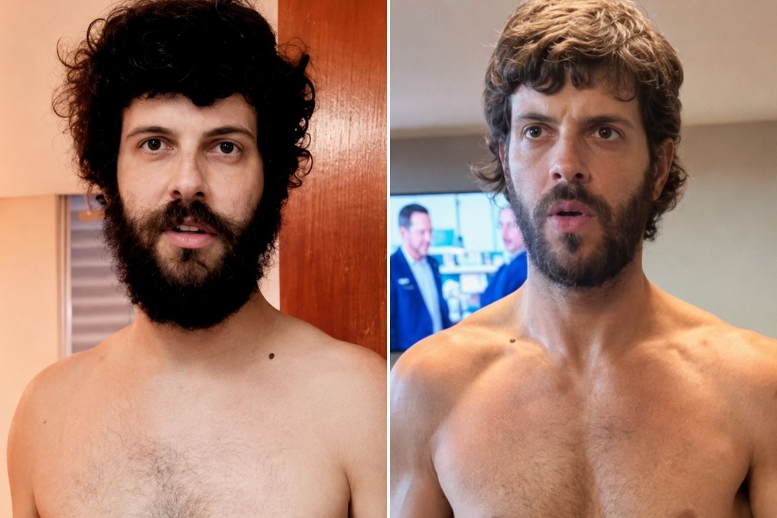 Diogo Defante Compartilha Antes E Depois Do Corpo Após Retirada De Tumor