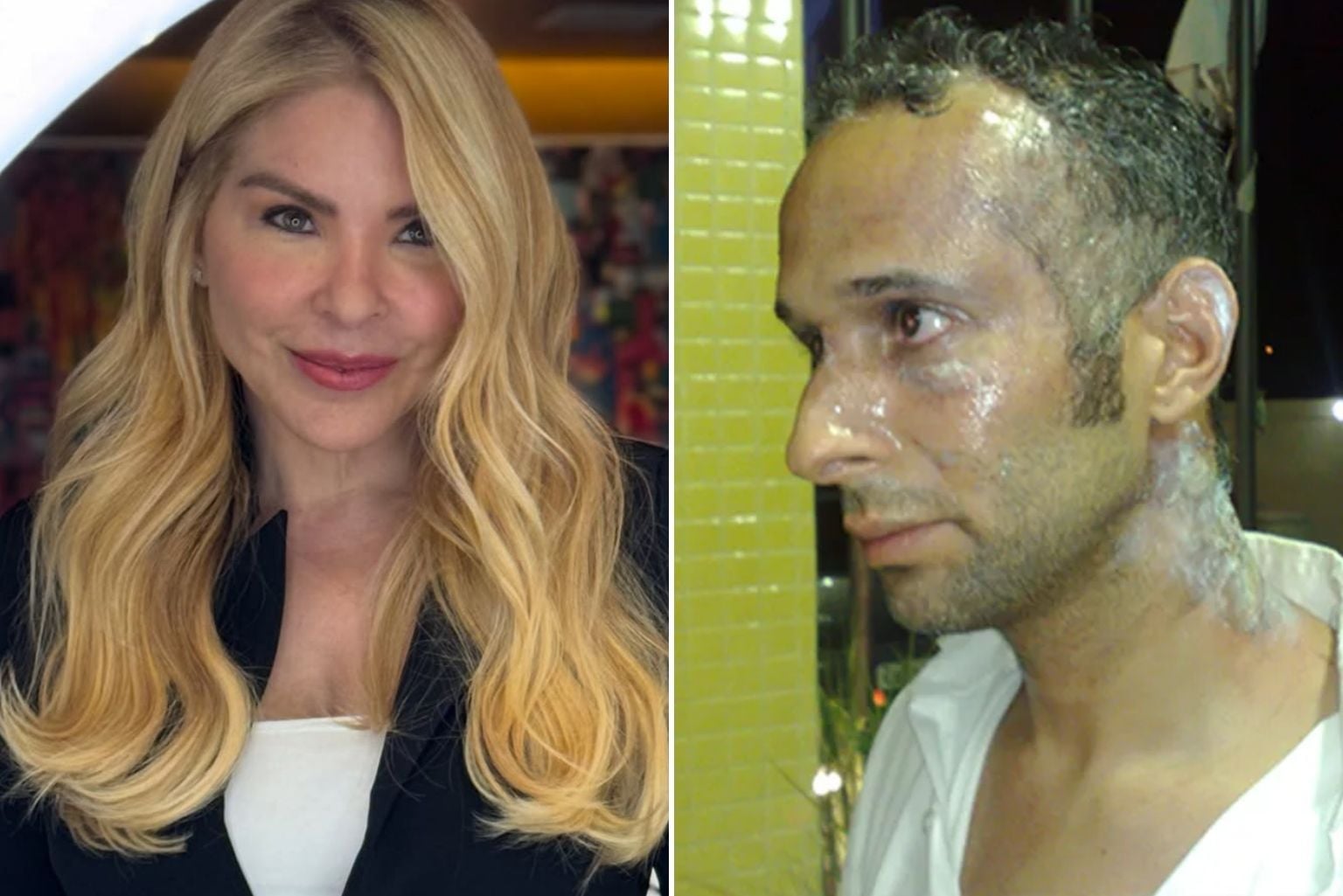 Queimaduras Pelo Corpo, Inseticida No Rosto E 20 Horas De Pânico: Ex De Veronica Costa Relata Momentos De Terror