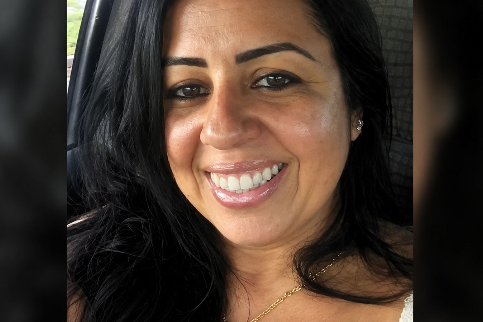 Professora morre após receber injeção para tratar queda de cabelo em salão Professora Morre Após Receber Injeção Para Tratar Queda De Cabelo Em Salão