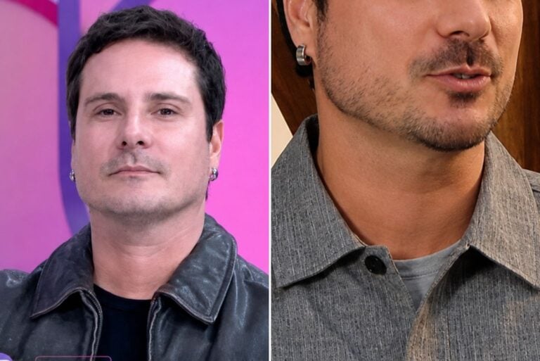 Sérgio Abreu Surge Com Novo Visual No Sbt Após Harmonização Facial