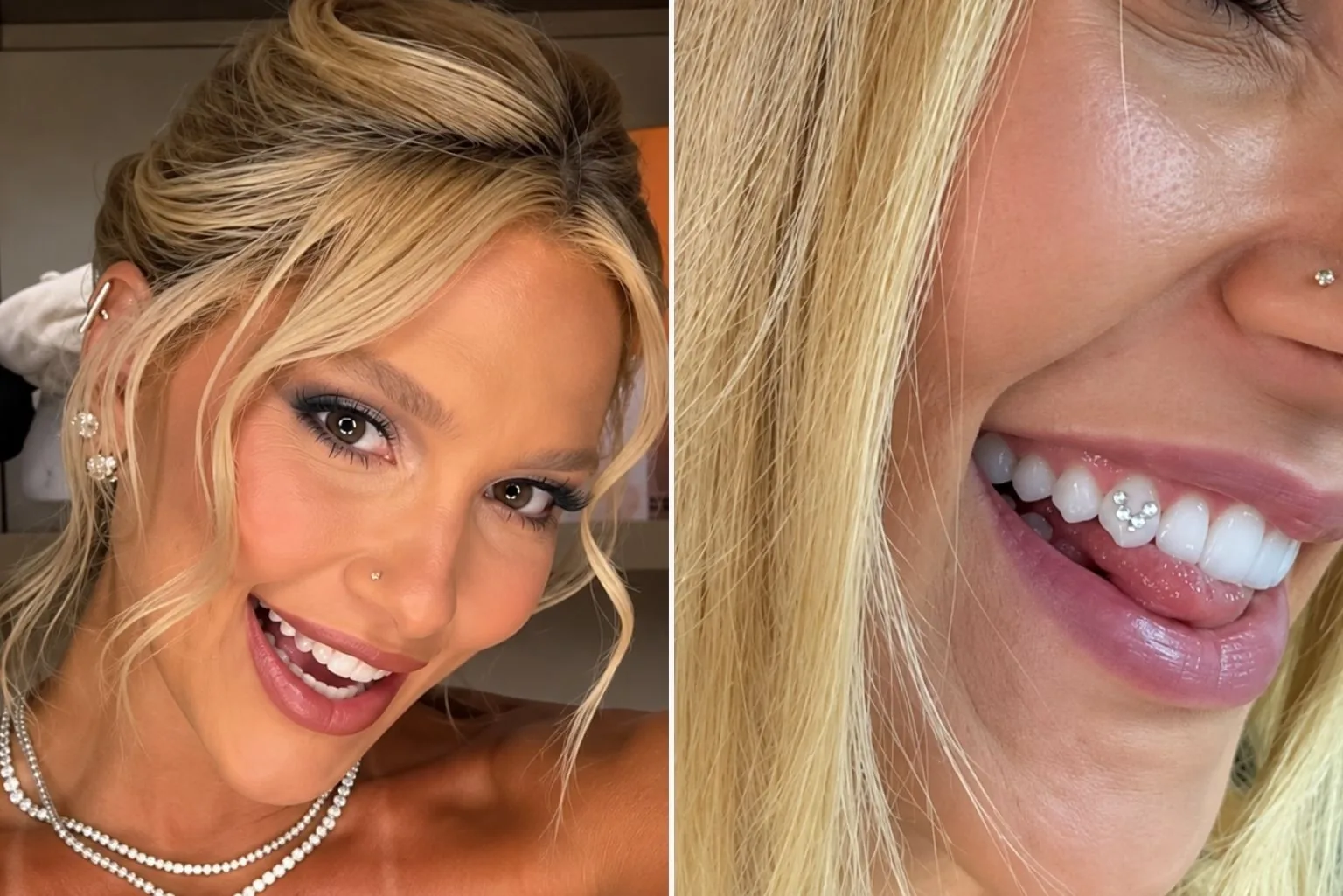 Virginia Fonseca Adere Ao Tooth Gem; Saiba O Que É A Joia Dental E Quais São Os Cuidados